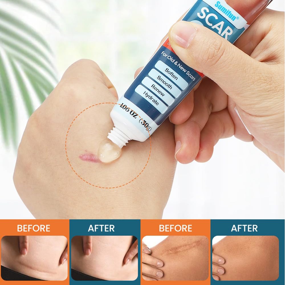 Scar Gel, Advanced Silicone Scar Removal Cream for Old & New Scars, 30g