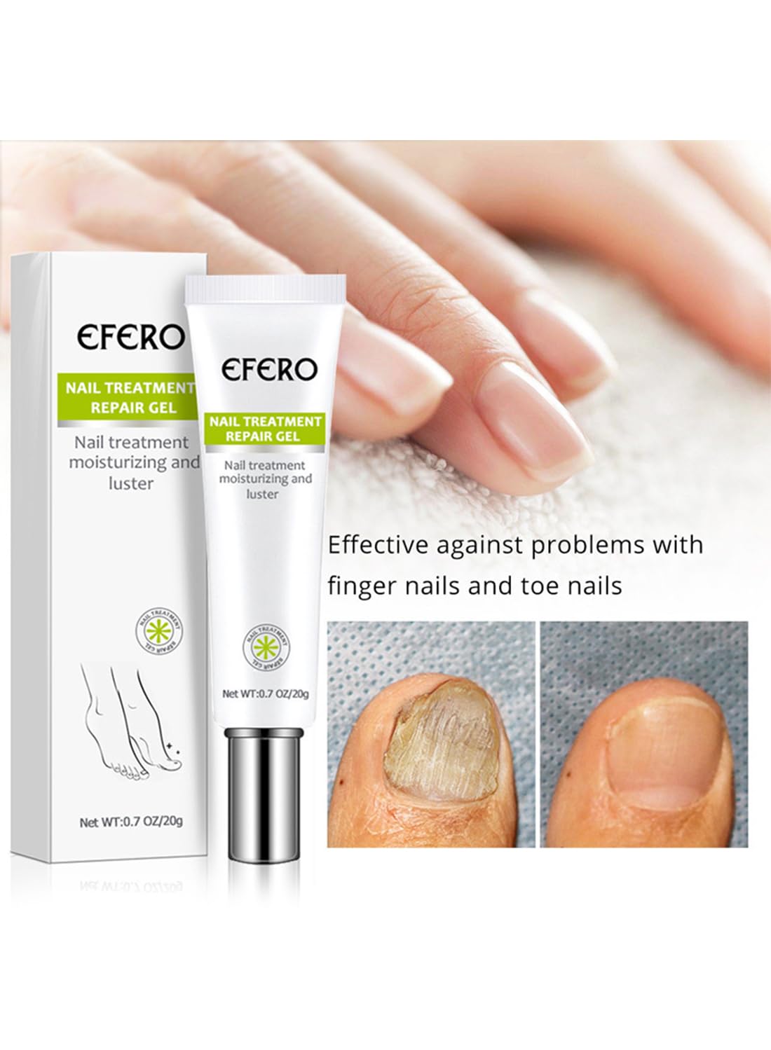 Nail Treatment Repair Gel, Nail Repair Cream, Restores Appearance of Discolored & Damaged Nails, Nail Grooming Gel for Nail Growth Care 20g
