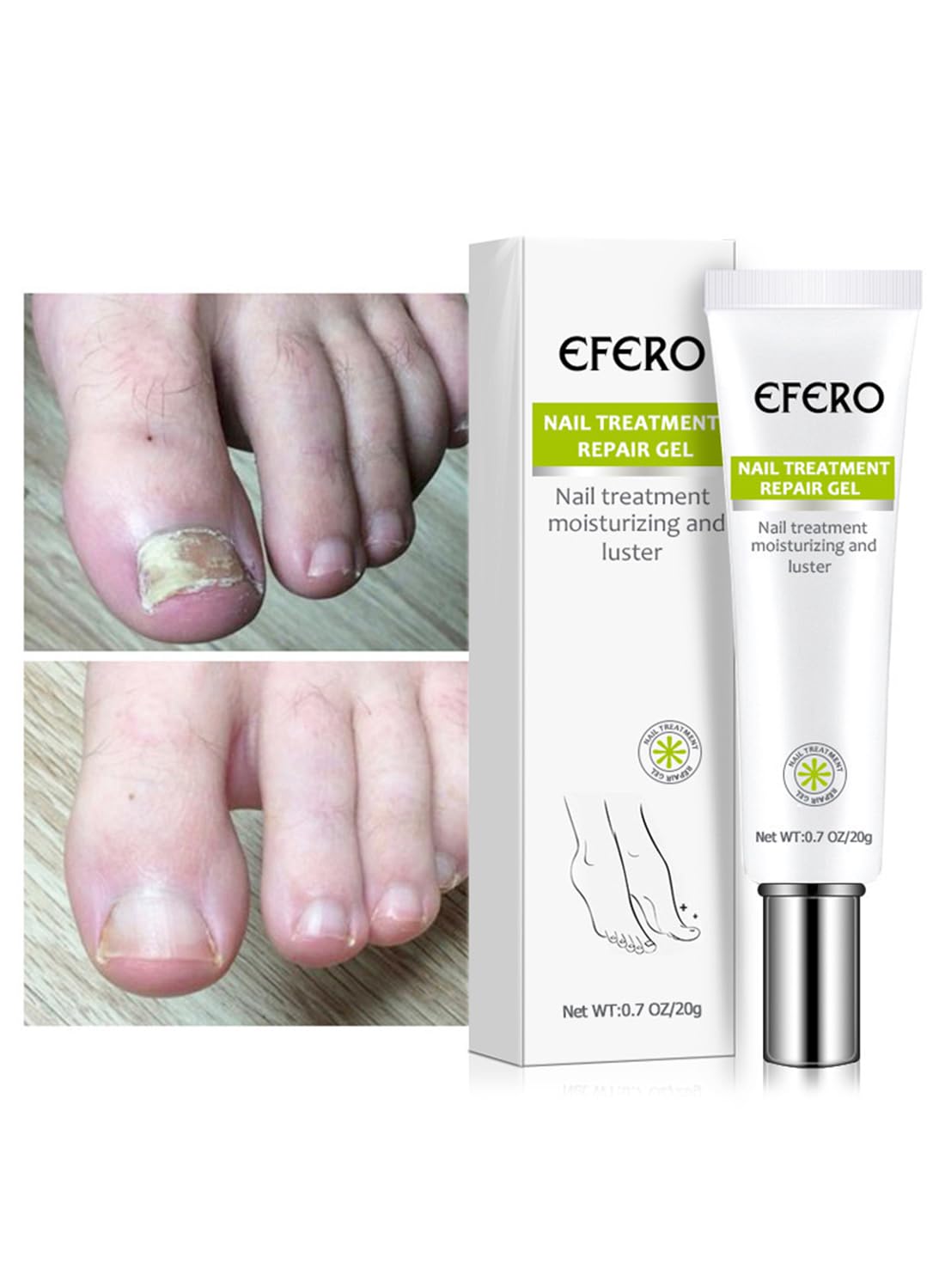 Nail Treatment Repair Gel, Nail Repair Cream, Restores Appearance of Discolored & Damaged Nails, Nail Grooming Gel for Nail Growth Care 20g