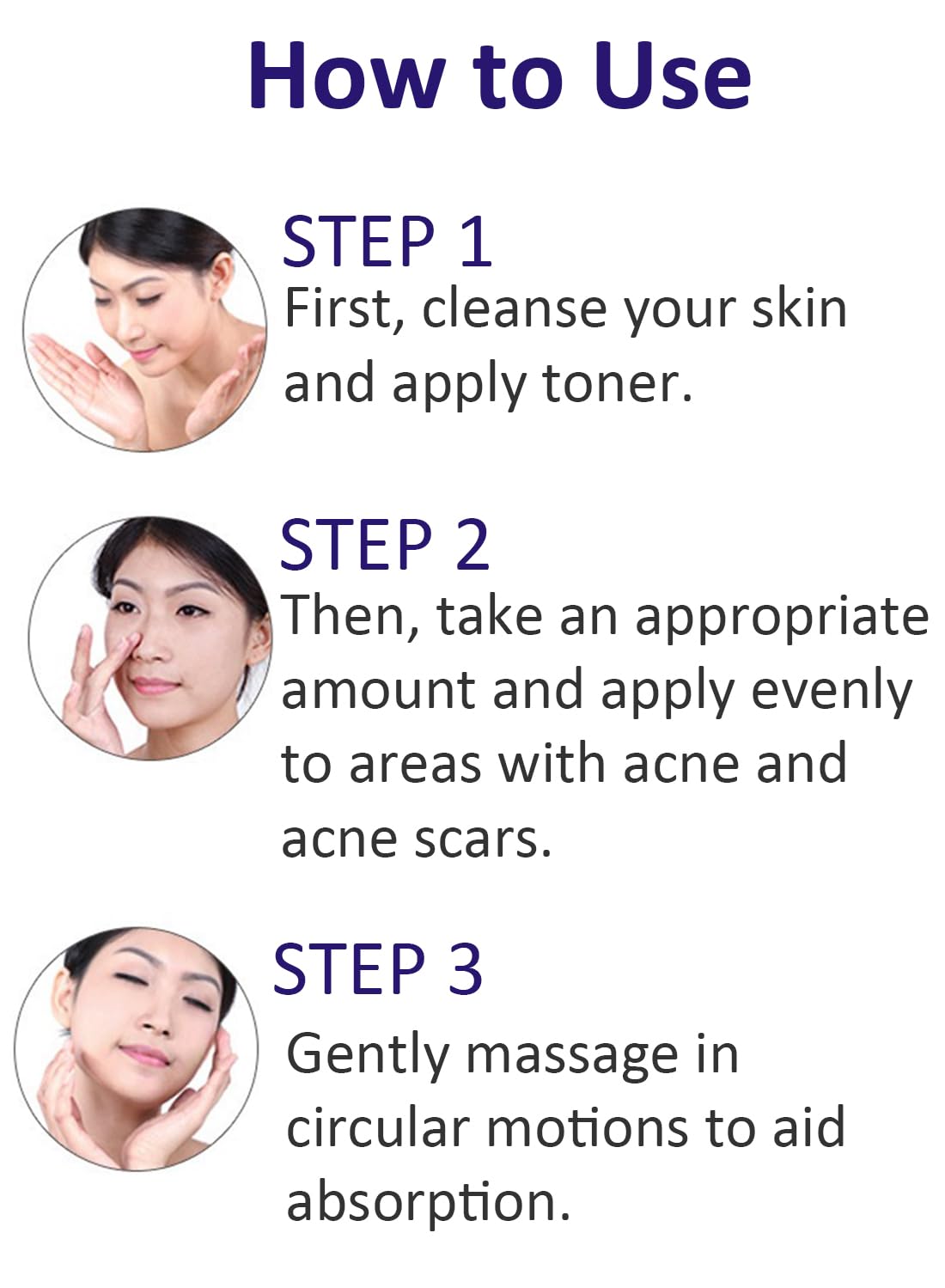 Anti-Acne Facial Treatment Cream, Gentle Face Moisturizer - 1 Pc 30g