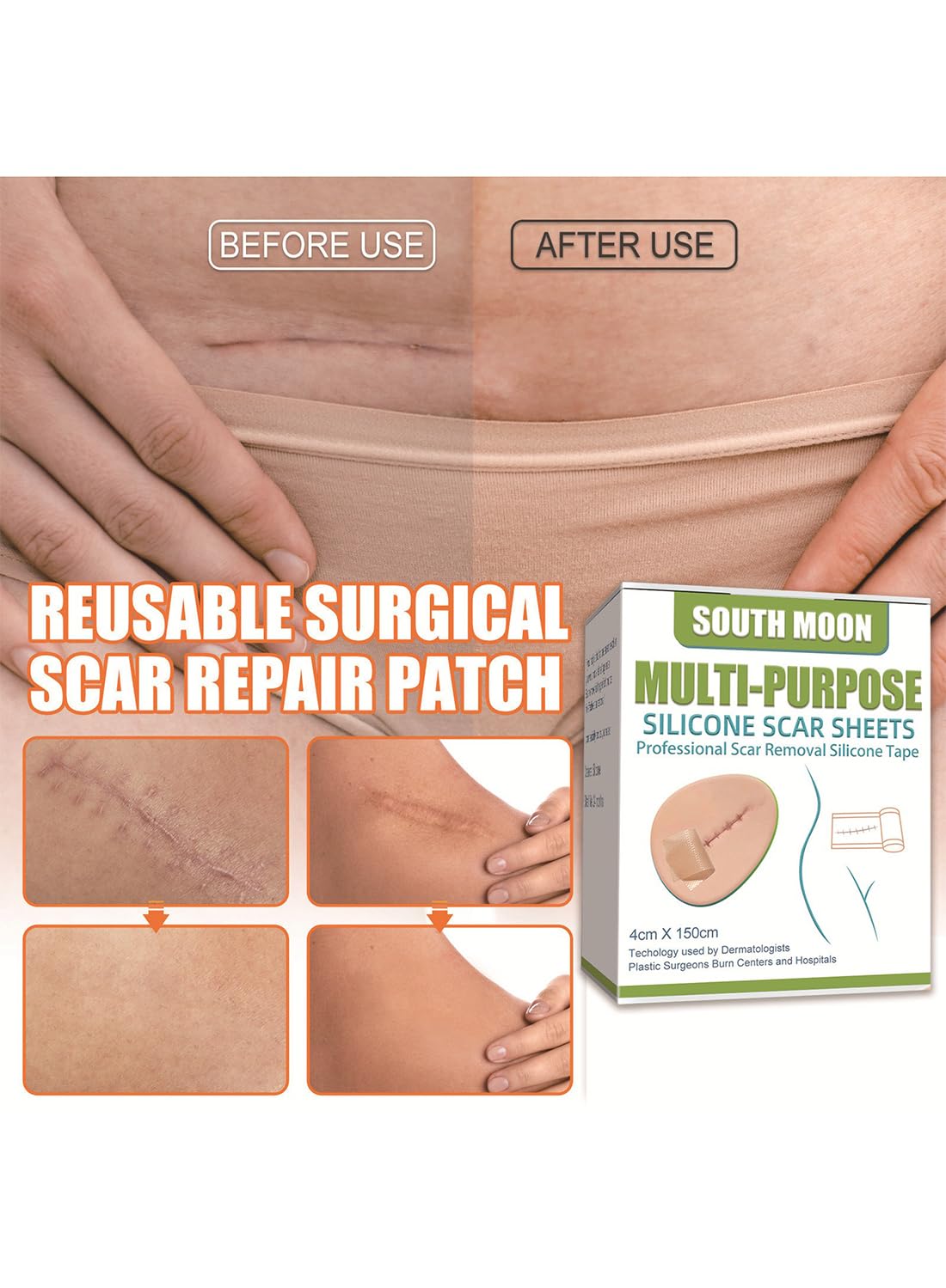 Multi-Purpose Silicone Scar Sheets, Breathable Scar Removal Strips 4*1.5m