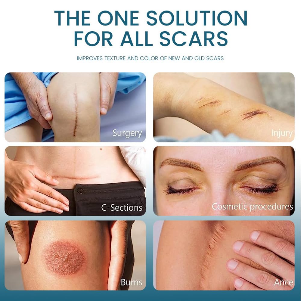 Scar Gel, Advanced Silicone Scar Removal Cream for Old & New Scars, 30g