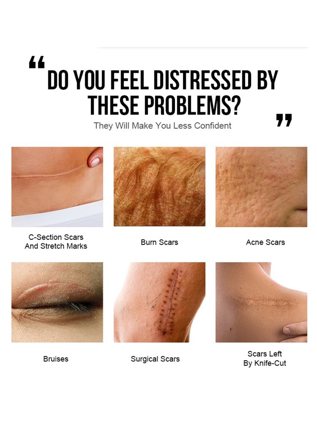 Scar Reducing Treatment, Intensive Repairing Scar Cream from Burns, Surgery 40g