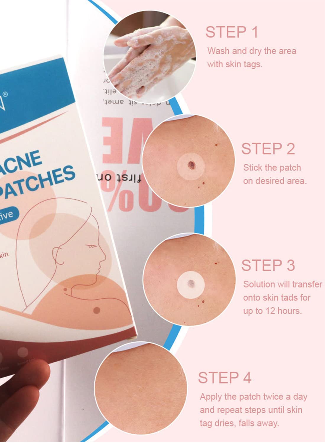 Skin Tag and Acne Removal Patches for Face and Body (108 Pcs)