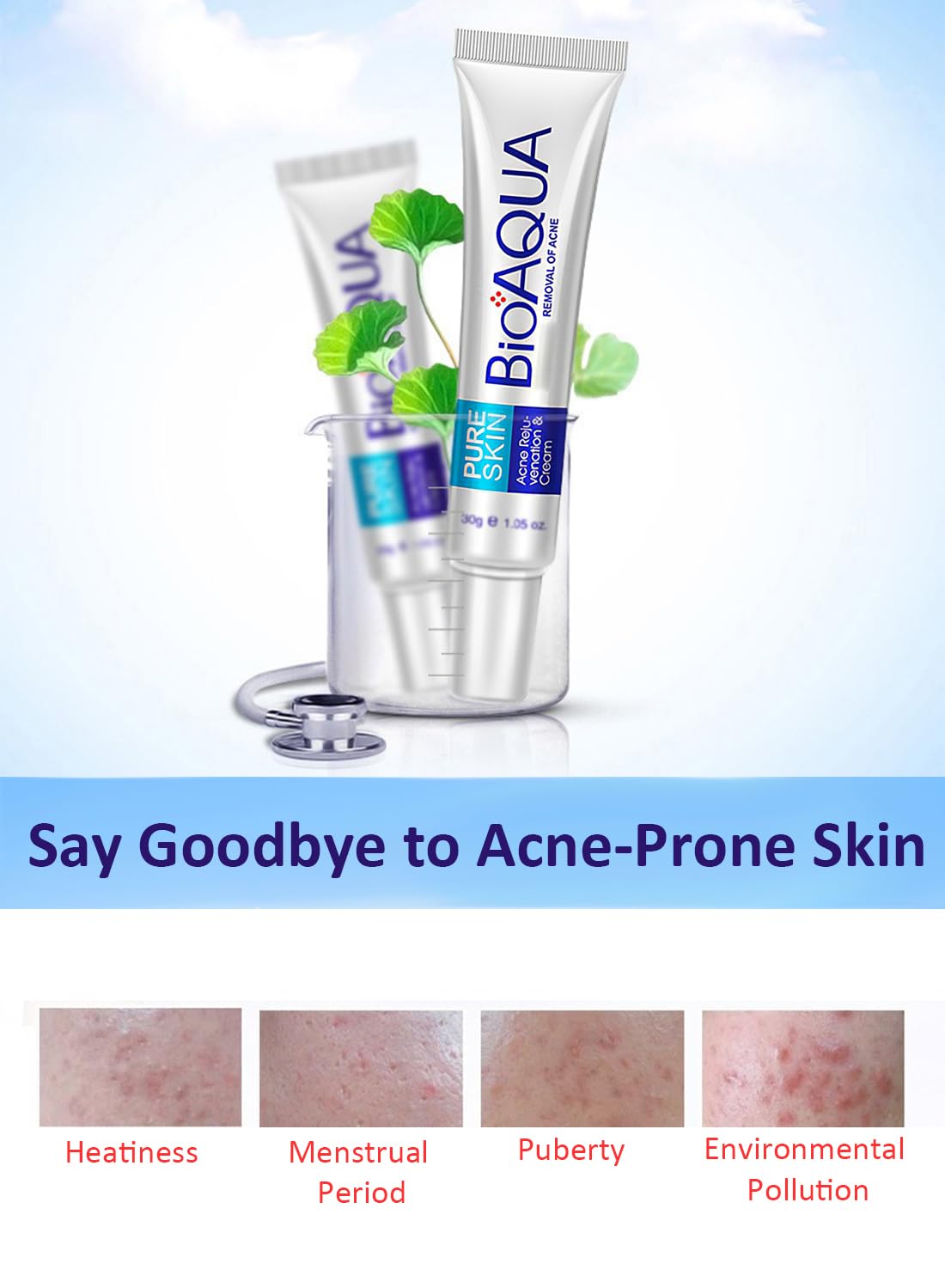 Anti-Acne Facial Treatment Cream, Gentle Face Moisturizer -  1 Pc 30g