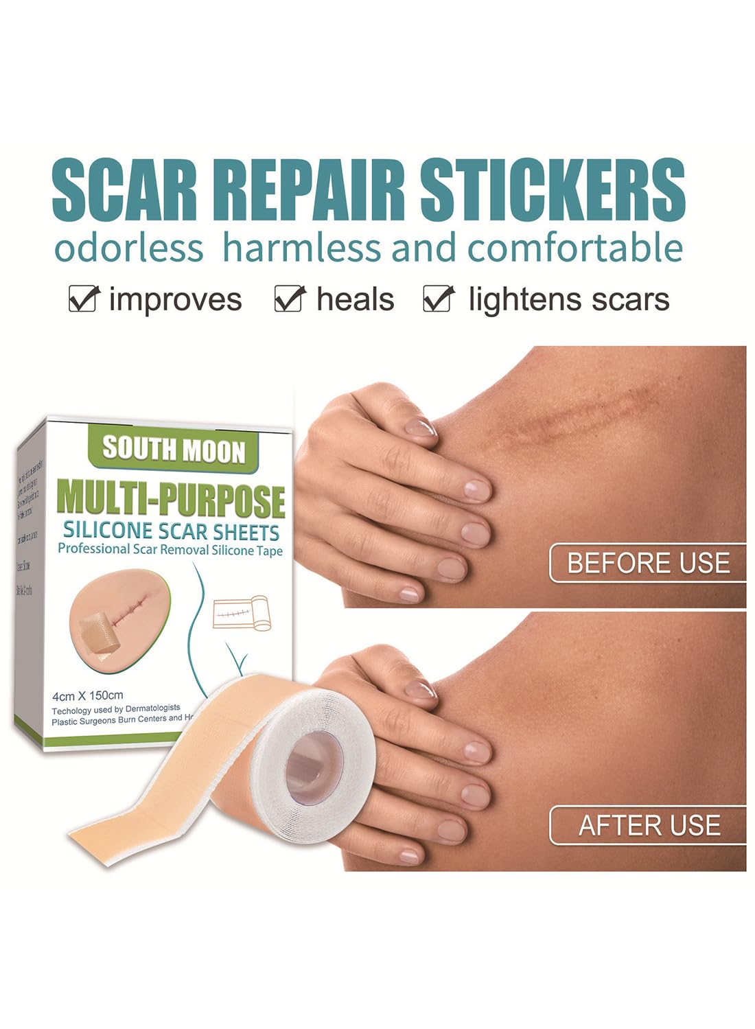 Multi-Purpose Silicone Scar Sheets, Breathable Scar Removal Strips 4*1.5m