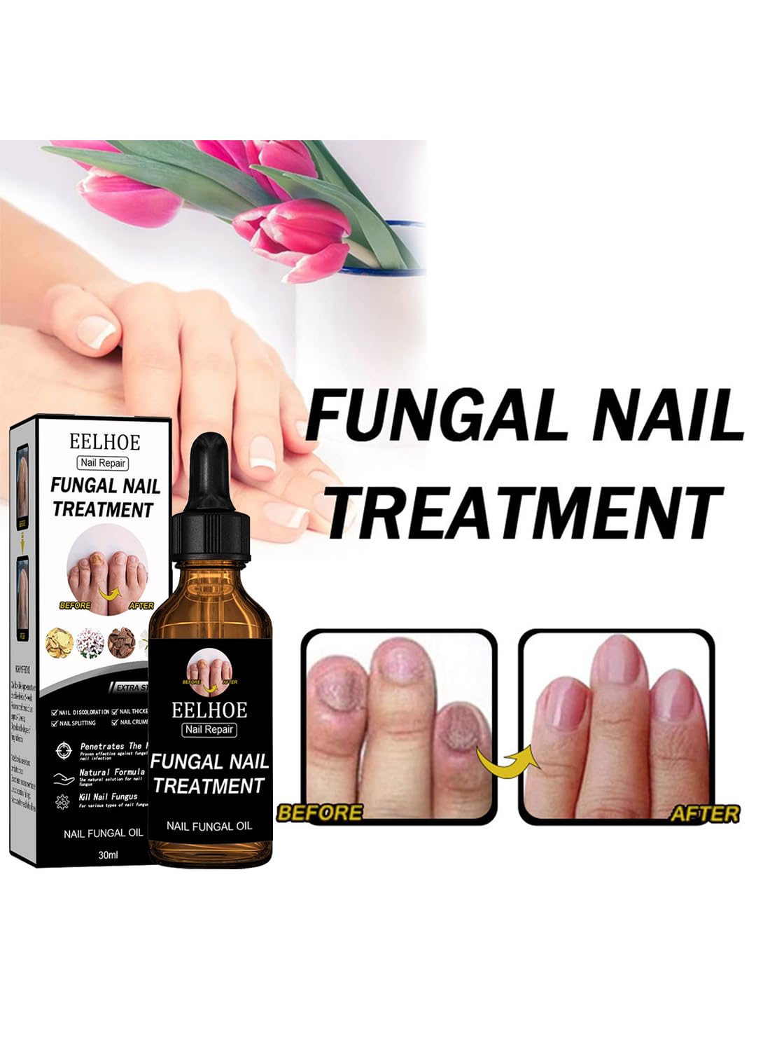 Nail Repair Treatment, Quickly Effective Nail Fungal Oil for Hands and Feet - 30ml