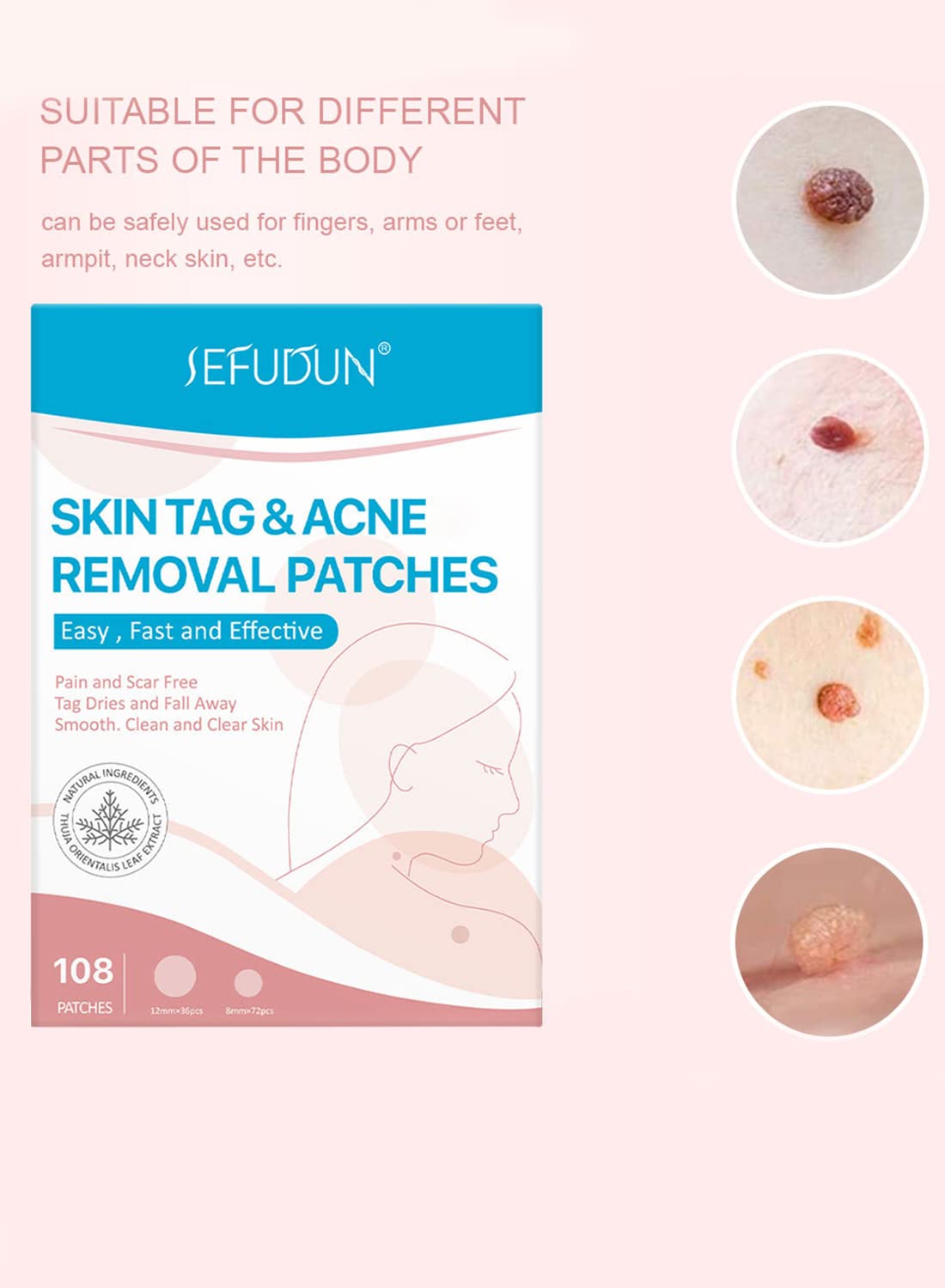 Skin Tag and Acne Removal Patches for Face and Body (108 Pcs)