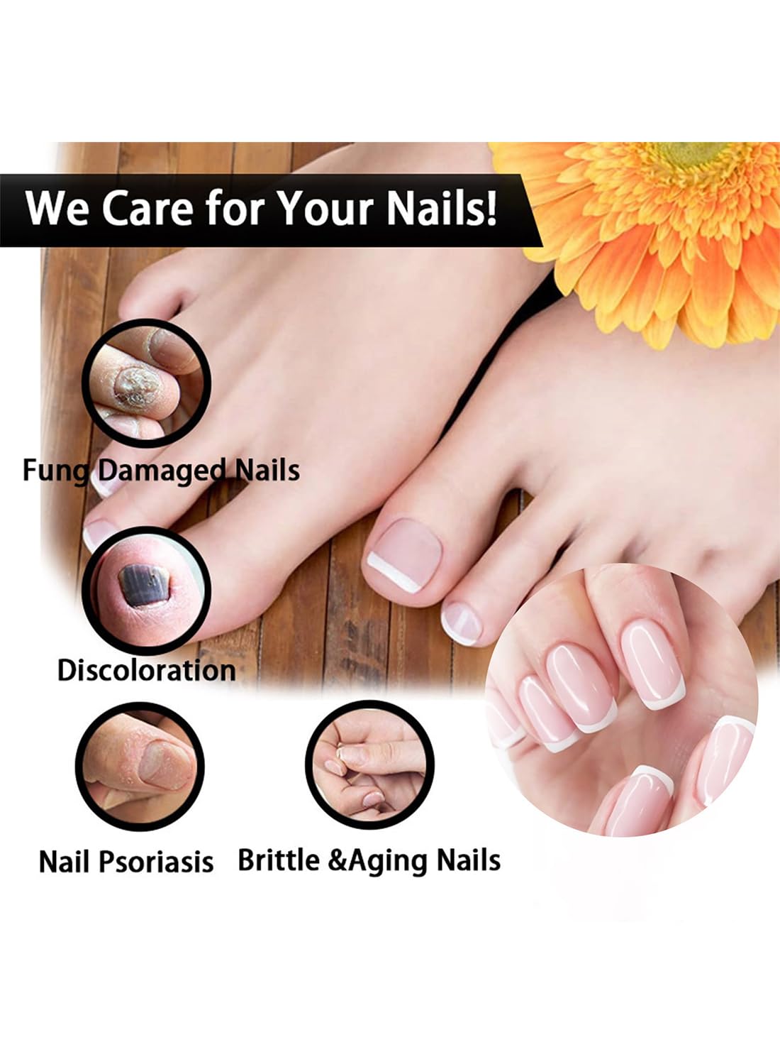 Nail Repair Treatment, Quickly Effective Nail Fungal Oil for Hands and Feet - 30ml