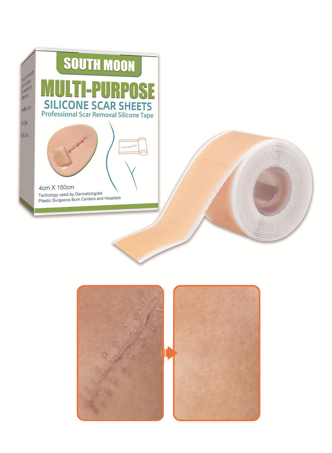 Multi-Purpose Silicone Scar Sheets, Breathable Scar Removal Strips 4*1.5m