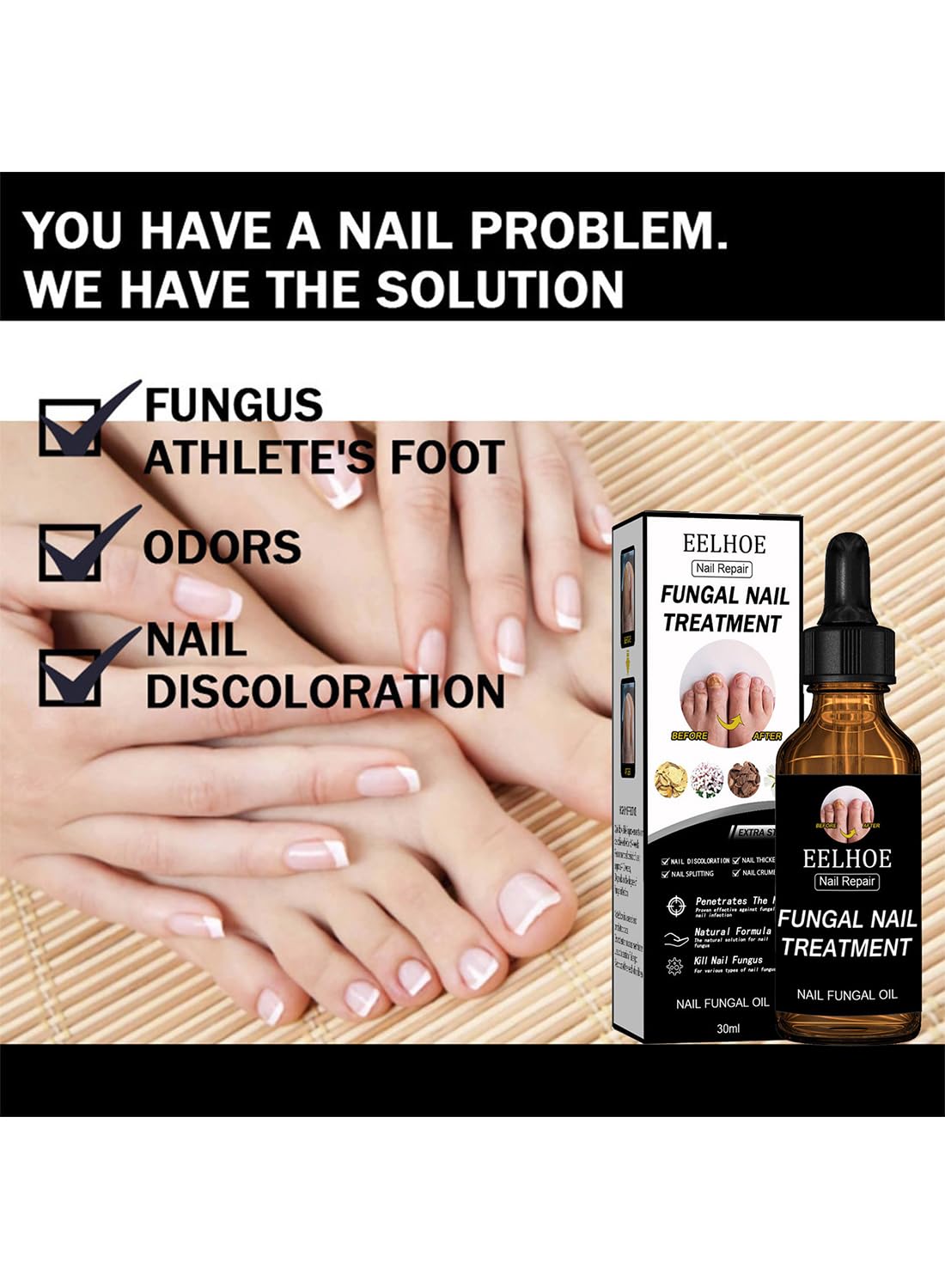 Nail Repair Treatment, Quickly Effective Nail Fungal Oil for Hands and Feet - 30ml