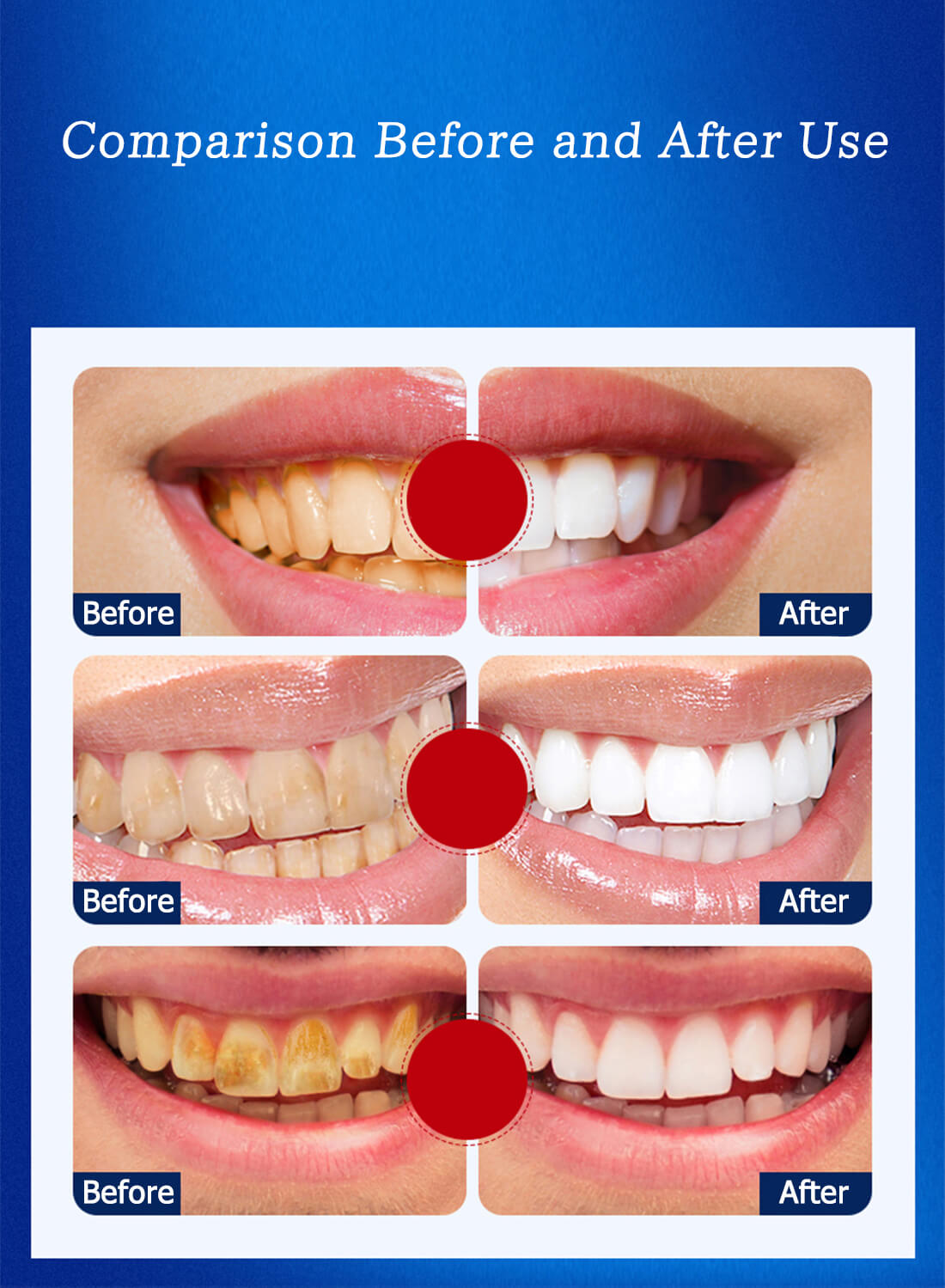 5D White Teeth Whitening Strips