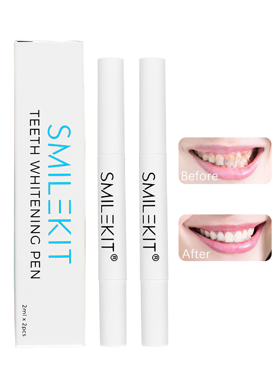 SMILEKIT 2Pcs Teeth Whitening Pen Kit