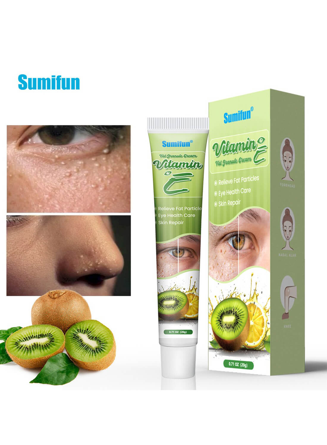 Vitamin E Fat Granule Cream, Eye Fat Removal Cream 20g