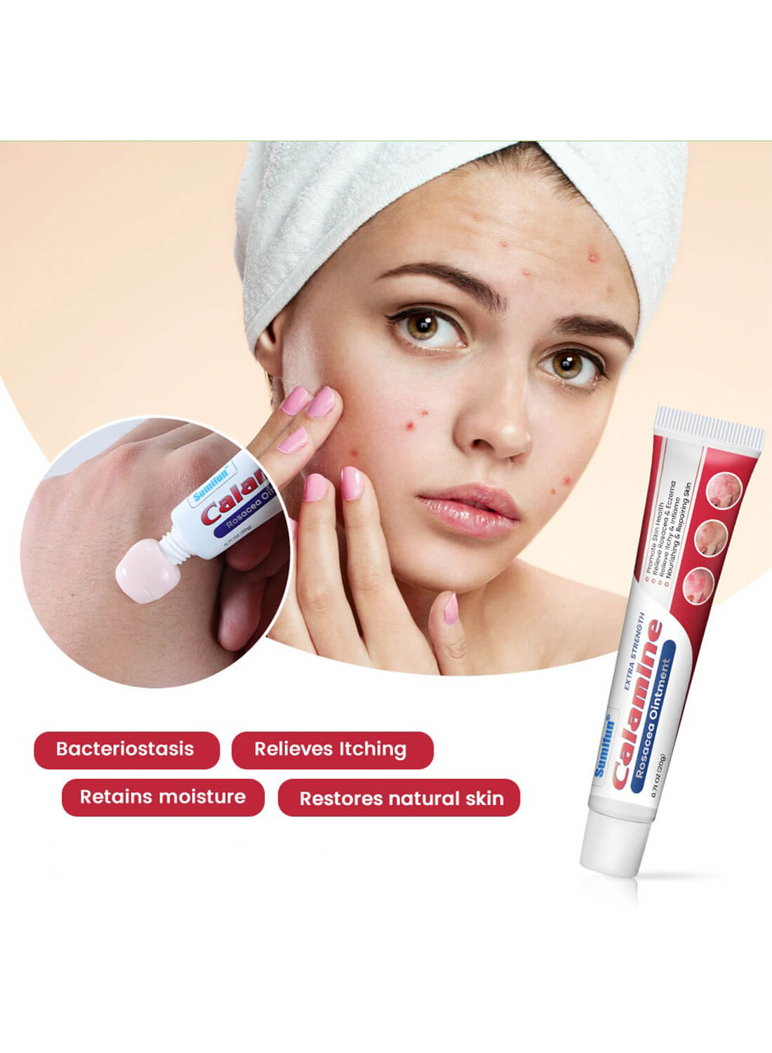 Calamine Rosacea Ointment, Effective Relieve Rosacea and Eczema 20g
