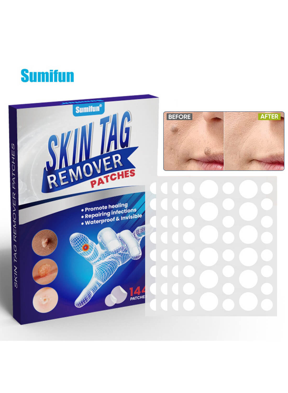 Skin Tag Remover Patches for Moles Skin Tag Acne Scars Corn144 Patches