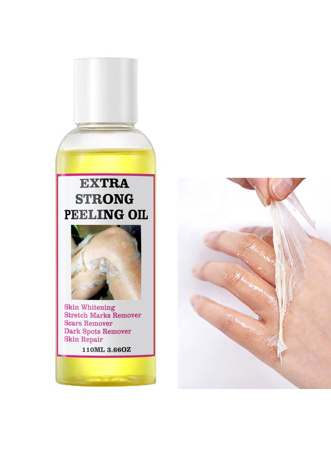 Extra Strong Peeling Oil for All Skin Type 110ml
